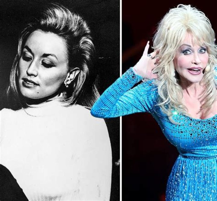 Discover Her Look Without a Wig